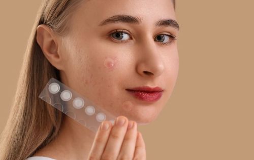 Girl wearing pimple patches while holding up a sheet of others